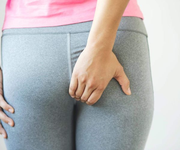 ריפוי טבעי לטחורים